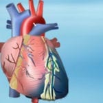 Absolute Arrhythmie